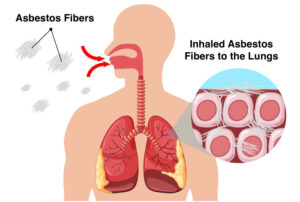 Diagram of asbestos fibers being inhaled into the lungs