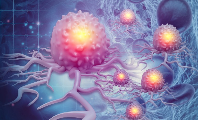cancer cells metastasizing