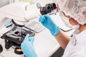 Doctor examining biphasic mesothelioma cells under a microscope 