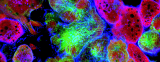 view of molecular profiles under a microscope