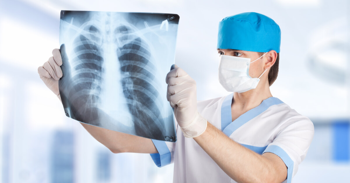 A doctor holds up a picture of a lung x-ray