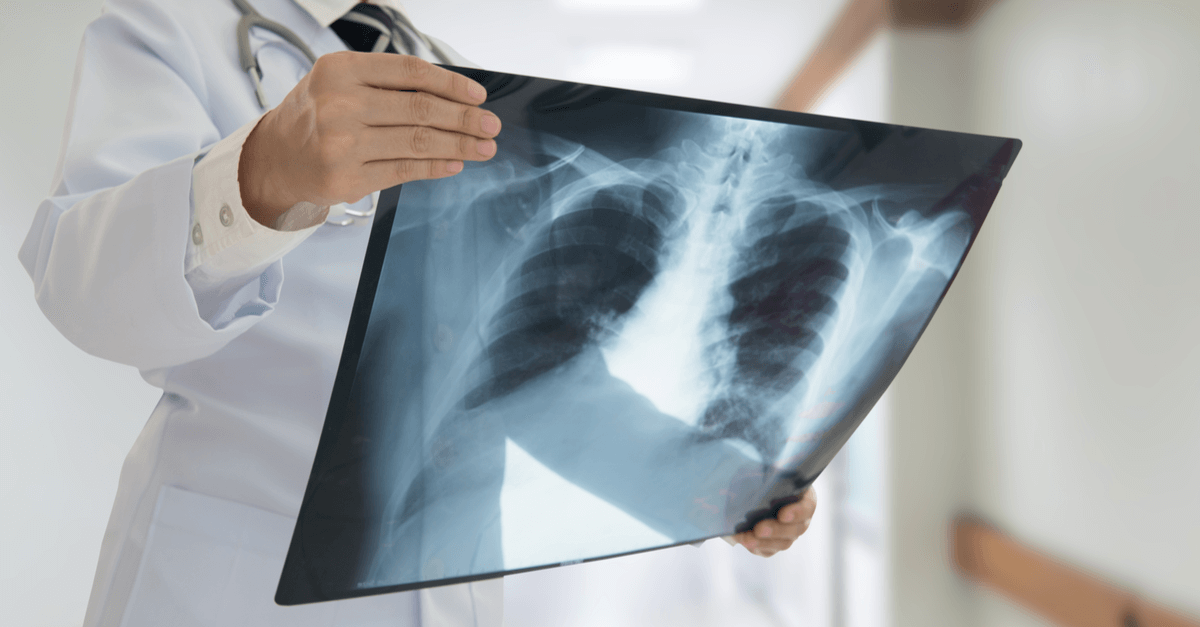 a medical professional holds up an X-ray