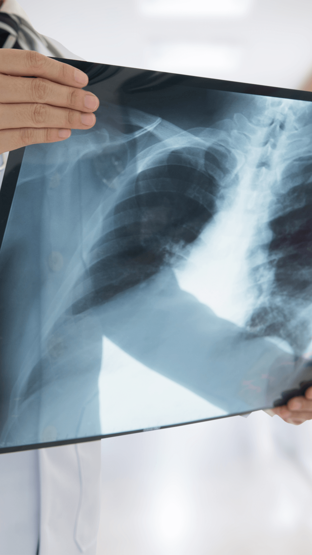 Doctor holds up an X-ray