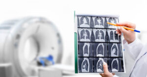 A doctor looks at a series of chest X-rays with an imaging machine in the background