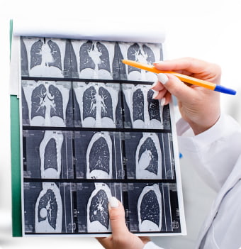 A doctor reviews imaging scans of the inside of the chest